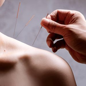 π USA Acupuncture Therapist Database USπΏ